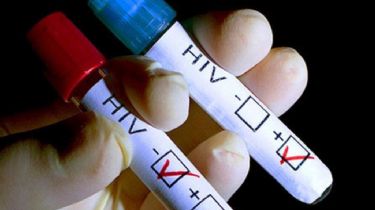 Argentina probará la eficacia de una vacuna contra el VIH