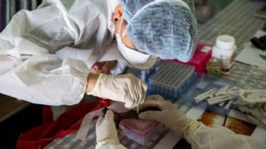 Nipah: El otro virus con potencial pandémico que preocupa a los científicos
