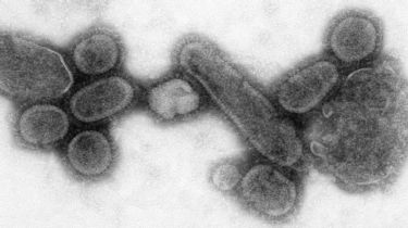 ¿Las restricciones contra el Coronavirus pudieron extinguir cepas del virus de la gripe humana?