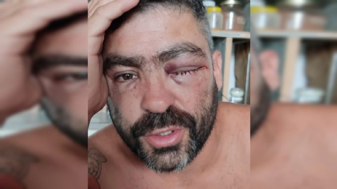 Robo piraña: Seis ladrones le dieron una brutal paliza a un músico para robarle su celular