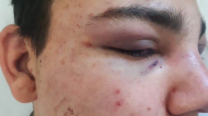 Lobería: Golpearon brutalmente a un joven hasta dejarlo inconsciente en la calle