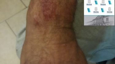 Quequén: Atacó a su padre con un caño, se peleó con la policía y fue reducido con disparos de balas de goma
