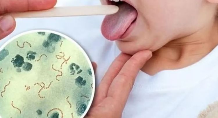 Streptococcus Pyogenes: La bacteria que alarma al país con 16 muertes y más de 100 casos confirmados