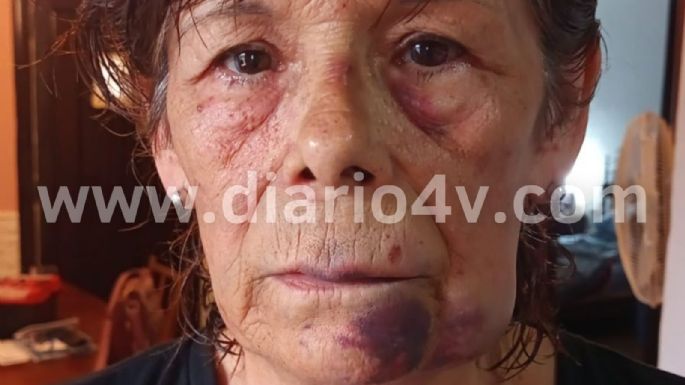 Robos y violencia a la orden del día: Encerraron y golpearon brutalmente a una mujer de 67 años en Quequén para robarle